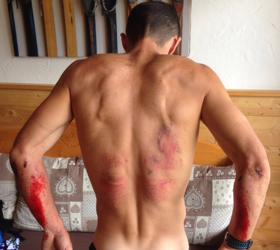 A-Aaaaaaaaaaaaaaaaaaaaaaactoeuropa3